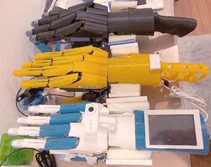 electric prosthetic hand and AI prosthesis